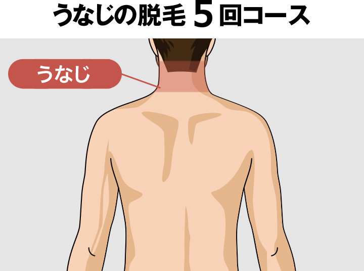 うなじ 襟足脱毛 メンズ永久脱毛 男性医療脱毛ならゴリラ脱毛